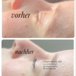 Lashlifting