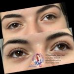 Lashlifting