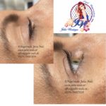Lashlifting