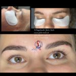Lashlifting